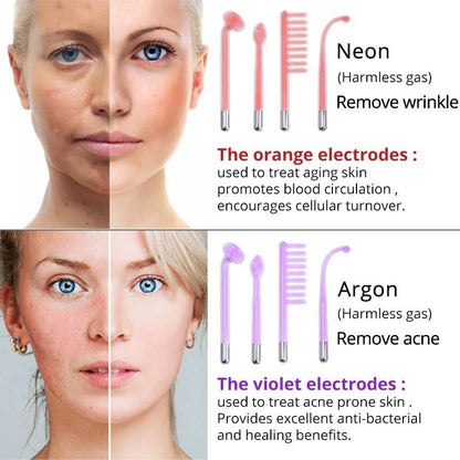 DermaLux | High Frequency Wand – Reduce Acne, Wrinkles & Dark Spots