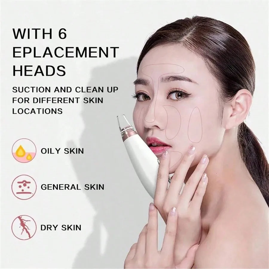 PoreVac | Electric Blackhead Remover – Extract Blackheads, Clean Pores & Reduce Acne