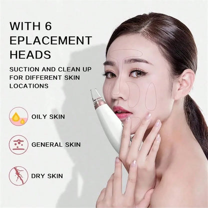 PoreVac | Electric Blackhead Remover – Extract Blackheads, Clean Pores & Reduce Acne