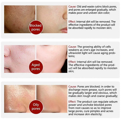 Retinol & Niacinamide Pore Refining Facial Serum