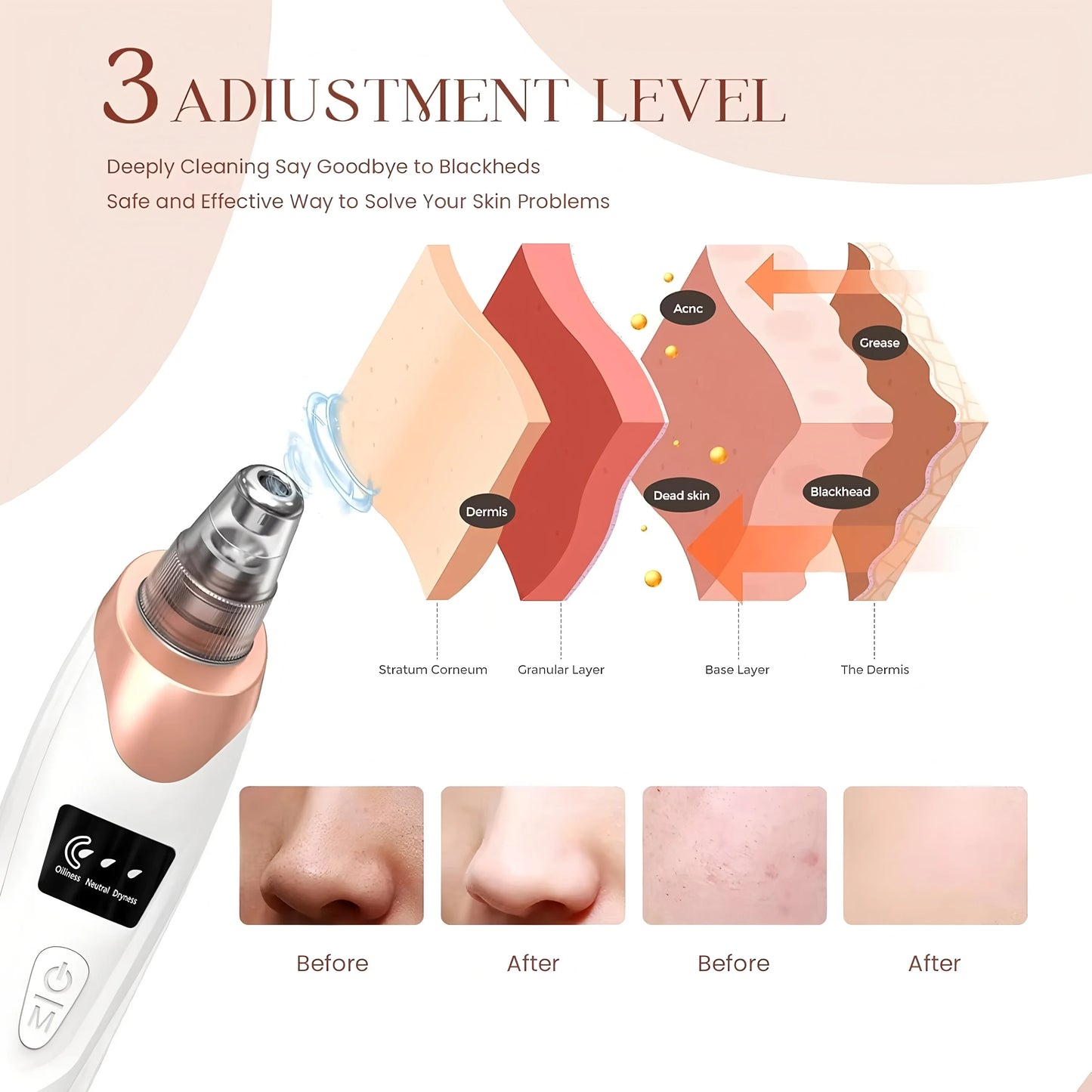 PoreVac | Electric Blackhead Remover – Extract Blackheads, Clean Pores & Reduce Acne