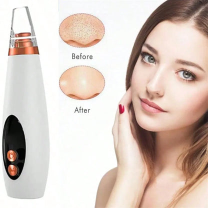 PoreVac | Electric Blackhead Remover – Extract Blackheads, Clean Pores & Reduce Acne