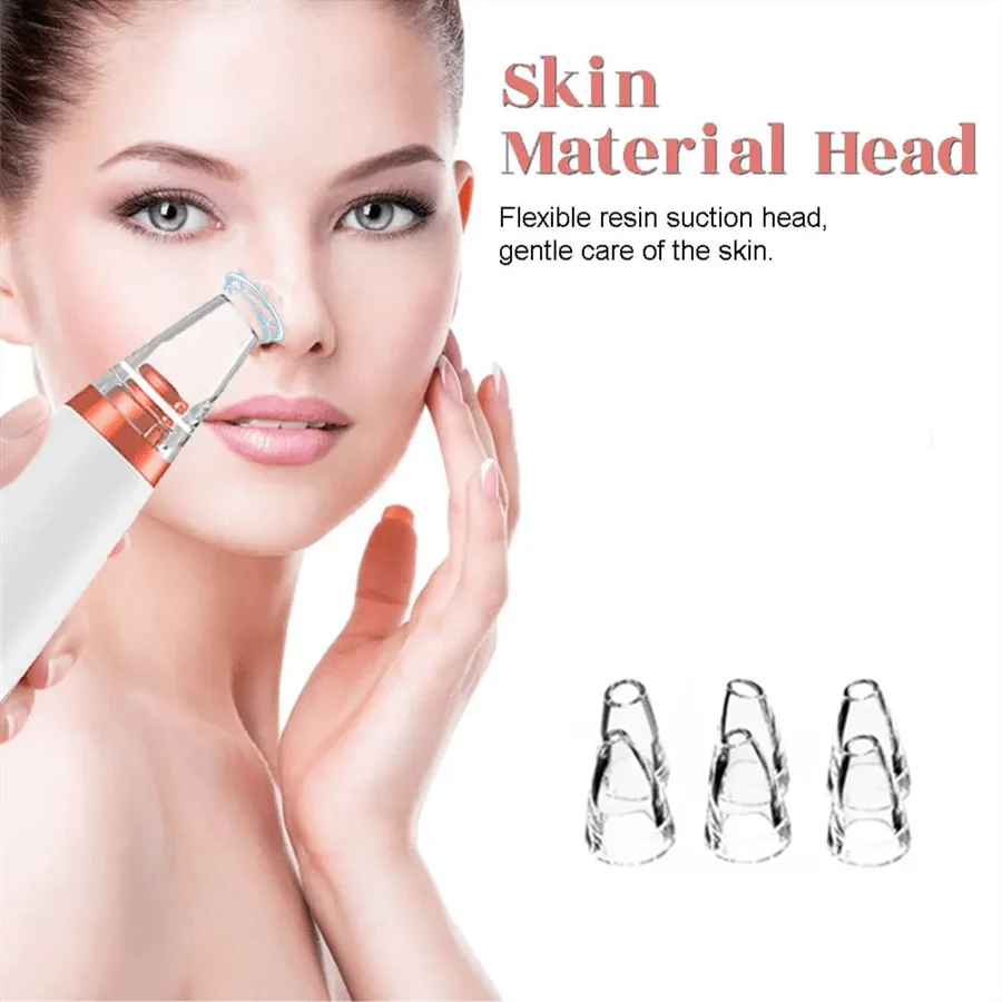 PoreVac | Electric Blackhead Remover – Extract Blackheads, Clean Pores & Reduce Acne