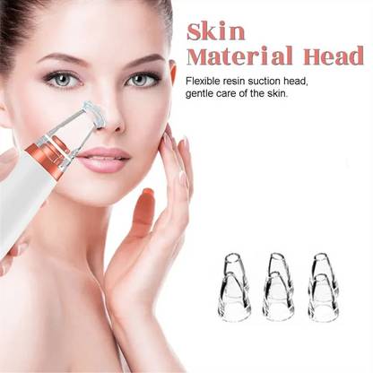 PoreVac | Electric Blackhead Remover – Extract Blackheads, Clean Pores & Reduce Acne