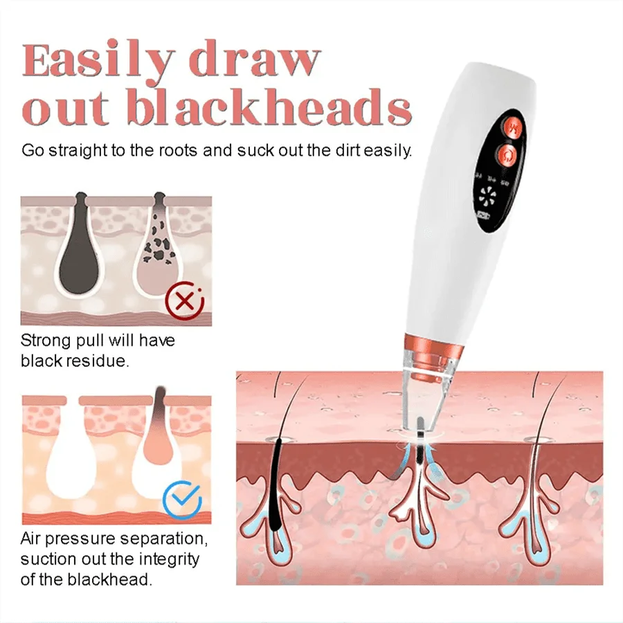 PoreVac | Electric Blackhead Remover – Extract Blackheads, Clean Pores & Reduce Acne