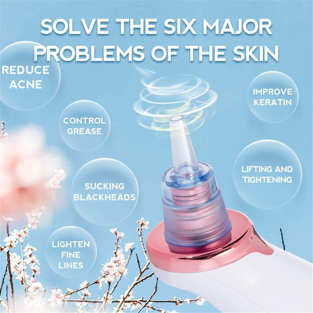 PoreVac | Electric Blackhead Remover – Extract Blackheads, Clean Pores & Reduce Acne