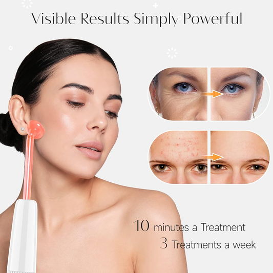 DermaLux | High Frequency Wand – Reduce Acne, Wrinkles & Dark Spots